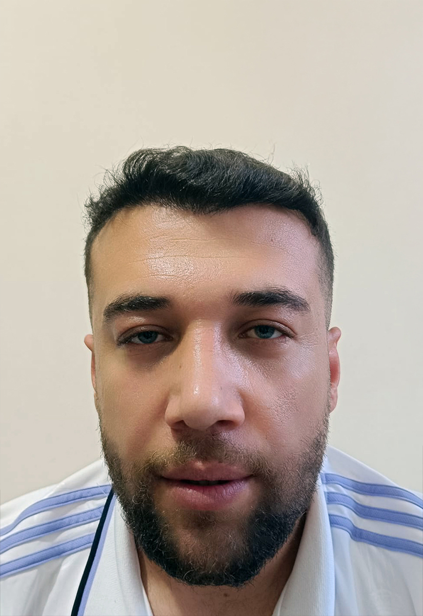 pelo-comparativa-02-B