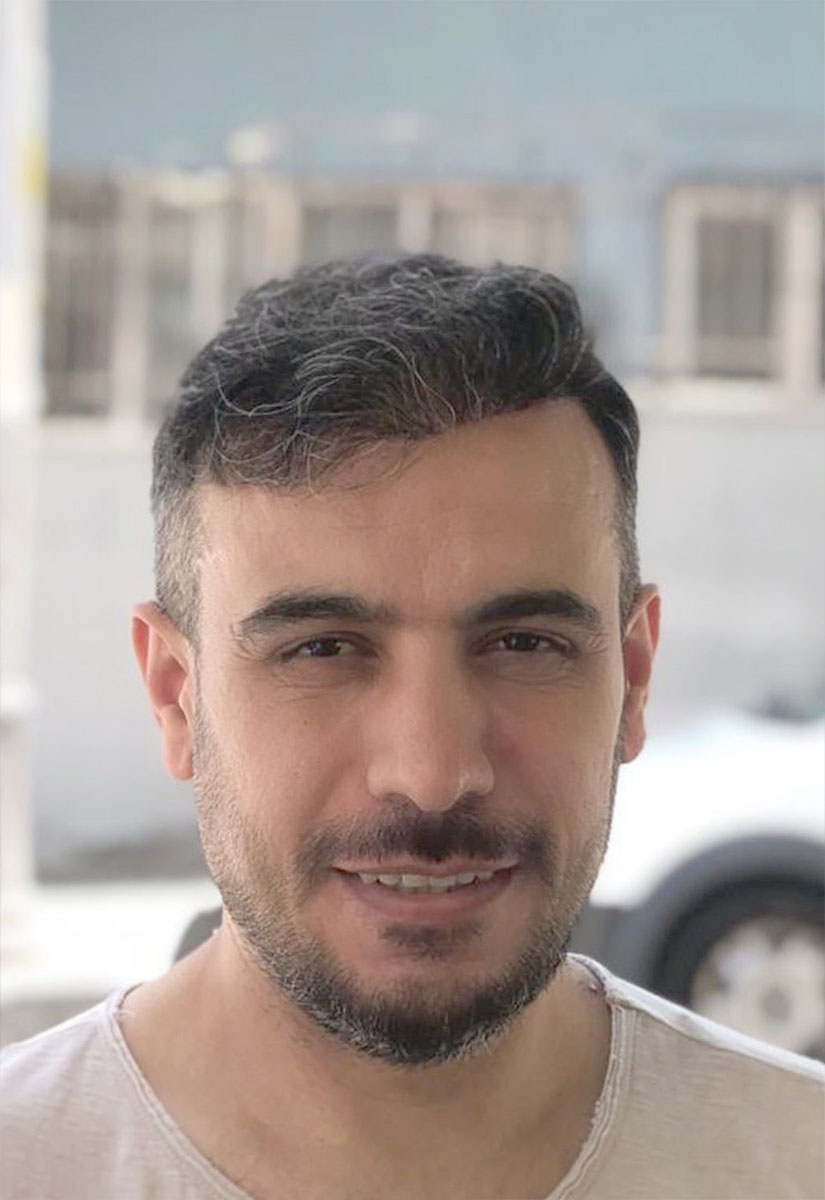 pelo-comparativa-03-B